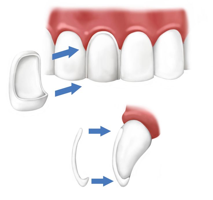 Best orthodontist in Dubai