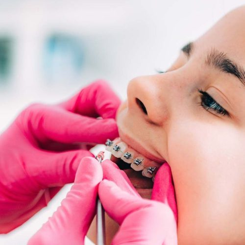 Orthodontist fixing girlâ€™s dental braces